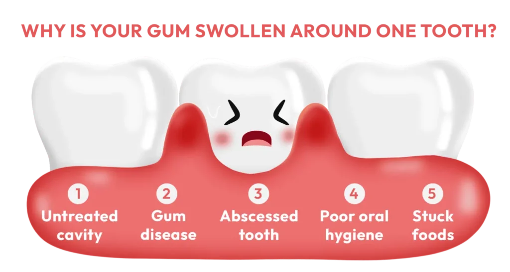 Why is my gum swollen around one tooth?
