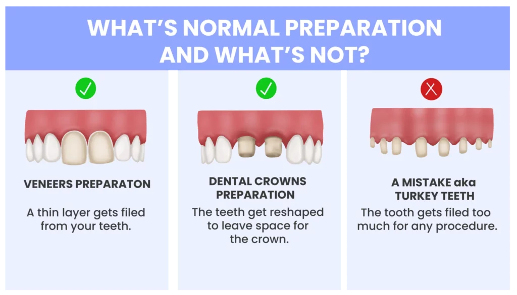 Turkey Teeth: can you trust dentistry in Turkey? A social media phenomenon explained.