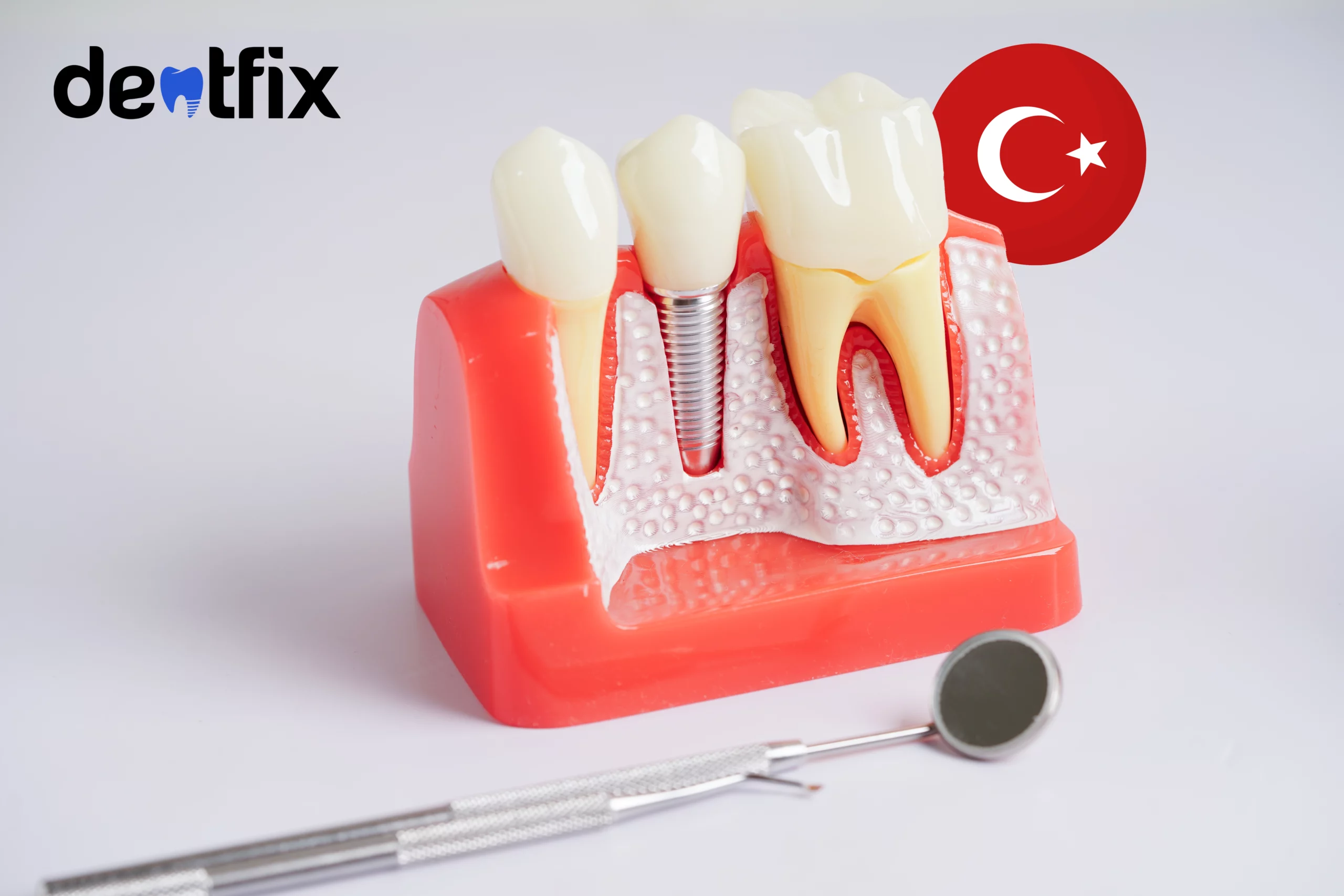 Dental Implants in Turkey: Why Turkey, Costs, and Tips!