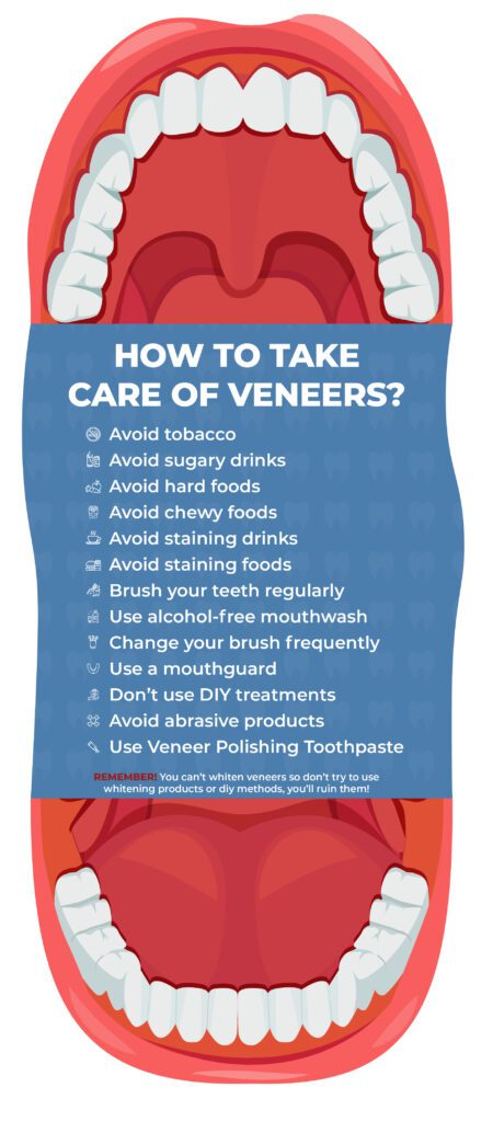 Veneers Maintenance: A Complete Guide